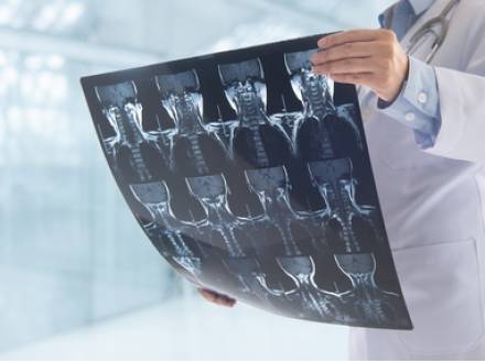 Hollister, CA workers’ compensation lawyer